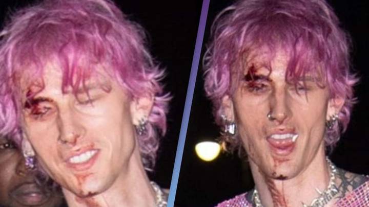 Machine Gun Kelly Spotted Leaving Party Covered In Blood
