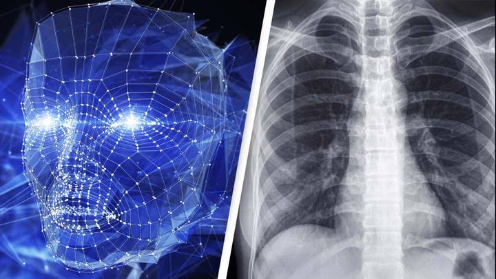 AI’s Ability To Predict Race From X-Rays Alone Sparks Concerns