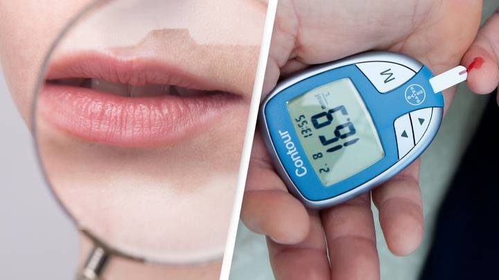 These Changes To Your Mouth Could Be A Sign Of Diabetes