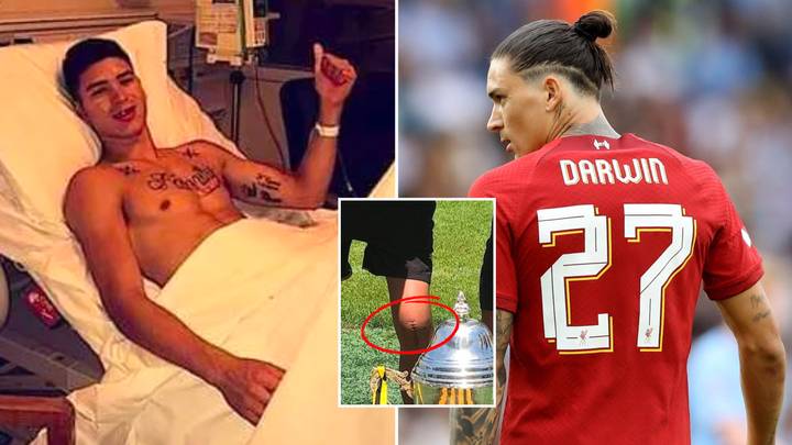 Darwin Nunez Suffered A Debilitating Knee Injury At 17-Years-Old Which Made Him Want To Quit Football