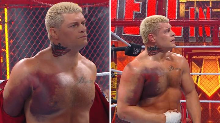 WWE Fans Left Shocked After Cody Rhodes Wrestles With Torn Pec, The Bruising Was Horrific