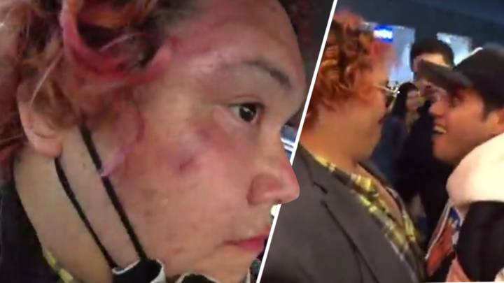 Twitch Streamer Physically Assaulted By Strangers Mid-Broadcast