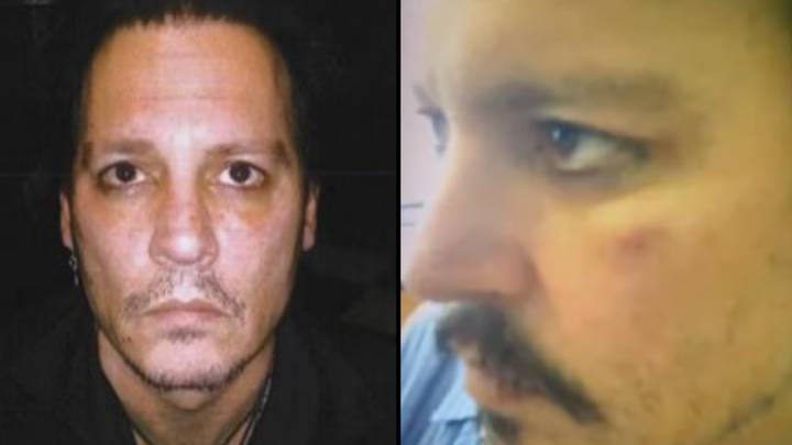 Johnny Depp’s Private Security Guard Shares Photos Of Injuries To The Actor’s Face