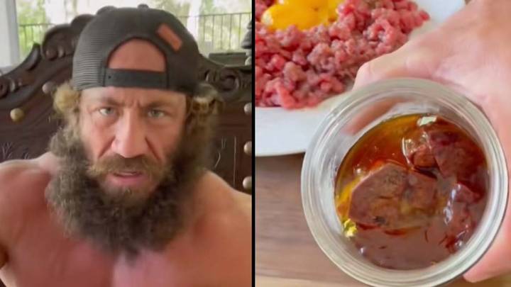 Doctor Reacts To Man Eating Raw Egg With Chopped Up Livers