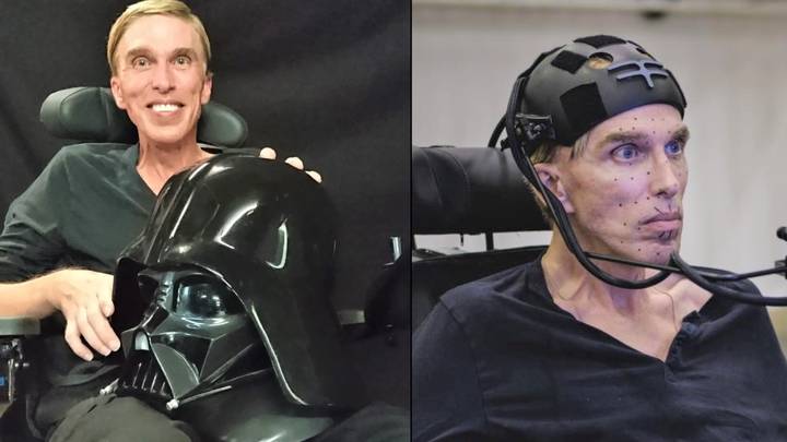 British Scientist Who Became 'World's First Cyborg' Dies Aged 64