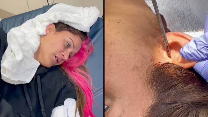 Doctor Pulls Cockroach Out Of Woman’s Ear After It Crawled Inside While She Was Asleep