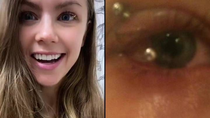 Woman who pierced her eyelid claims it's not as bad as you think it'd be