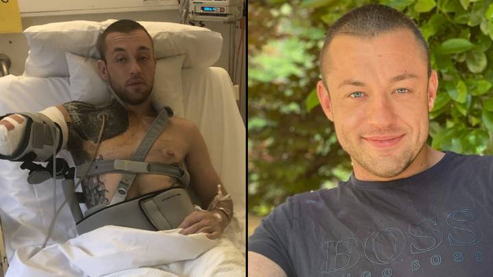 Man's Forearm Amputated After Botched Bicep Curl Left Him With Flesh-Eating Bug