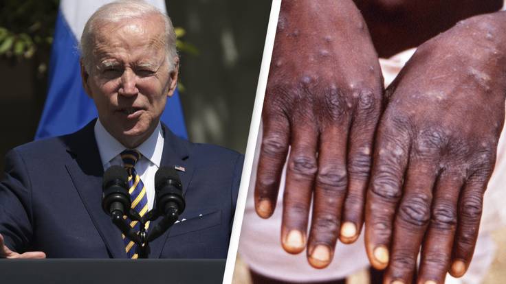 Joe Biden Says Monkeypox Is 'Something To Be Concerned About'