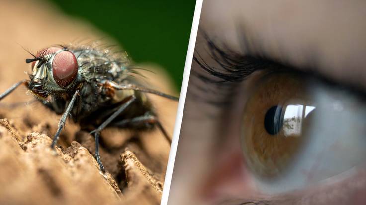 Man Becomes 'Pregnant With Flies' In His Eye Following Rare Disease