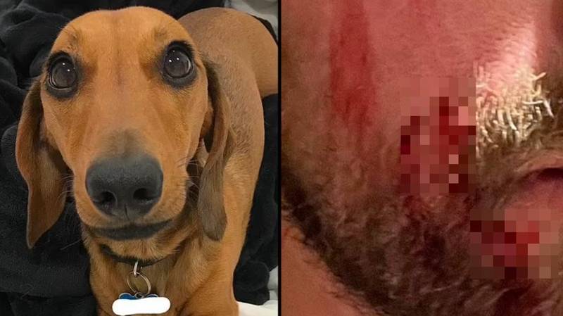 Woman stunned after sausage dog launches at husband and leaves him with stitches