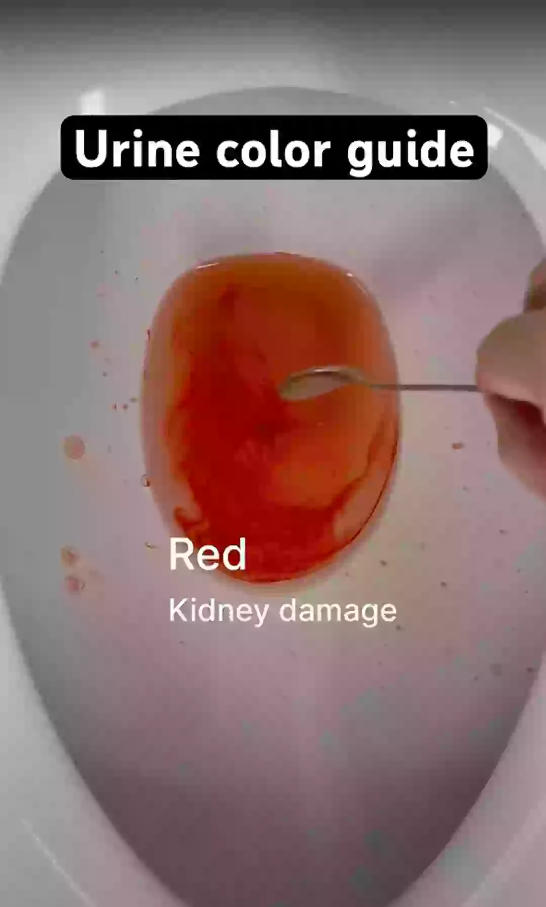 Normal Pee Gravity Color Video 'guide' explains what the color of your urine says about your ...