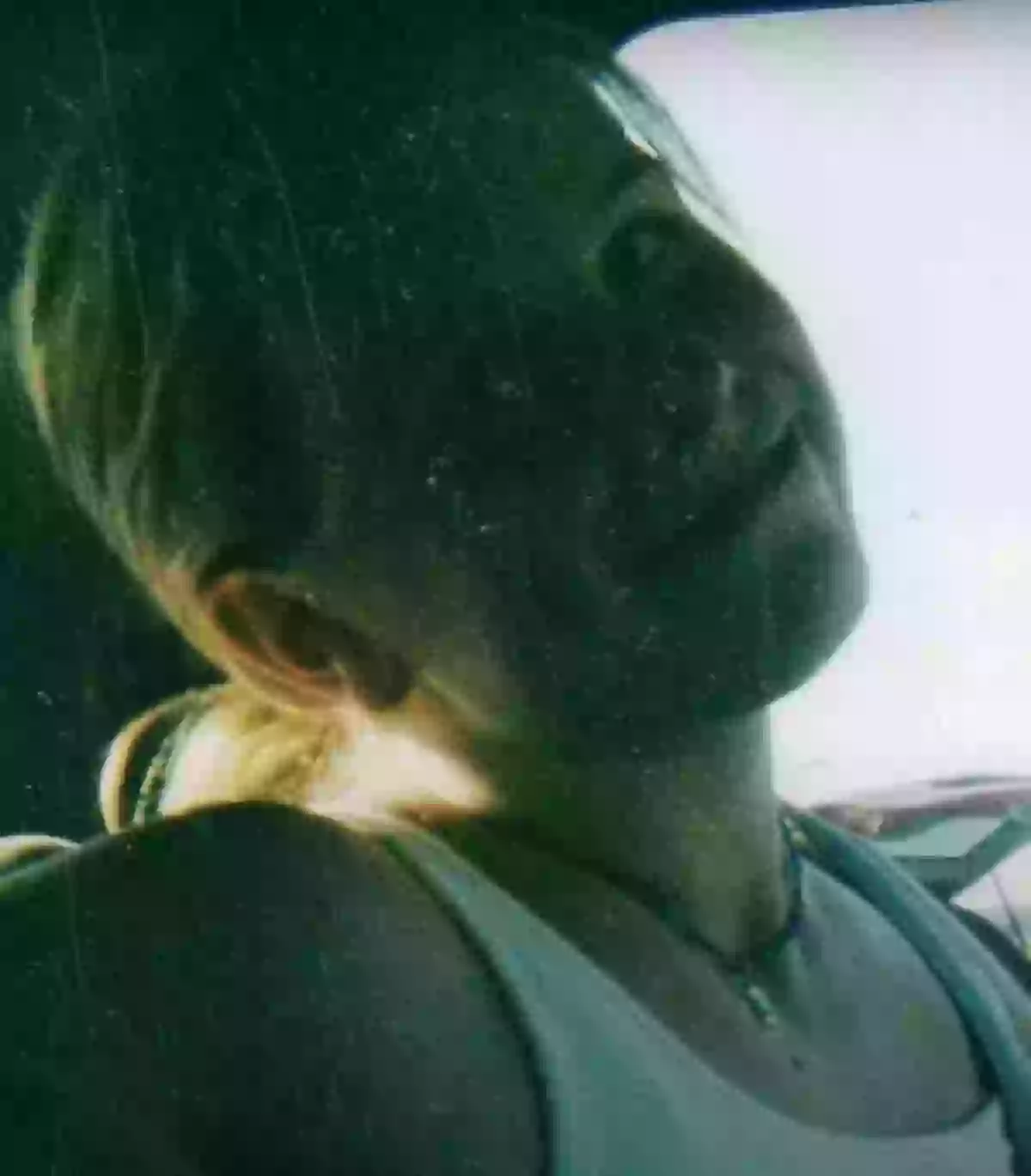 Woman who was hours from death became the first person ever to survive ...