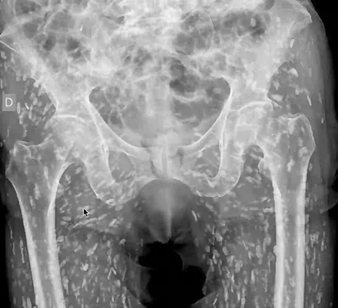 ER doctor breaks down horrifying scans that show parasite-infested body ...