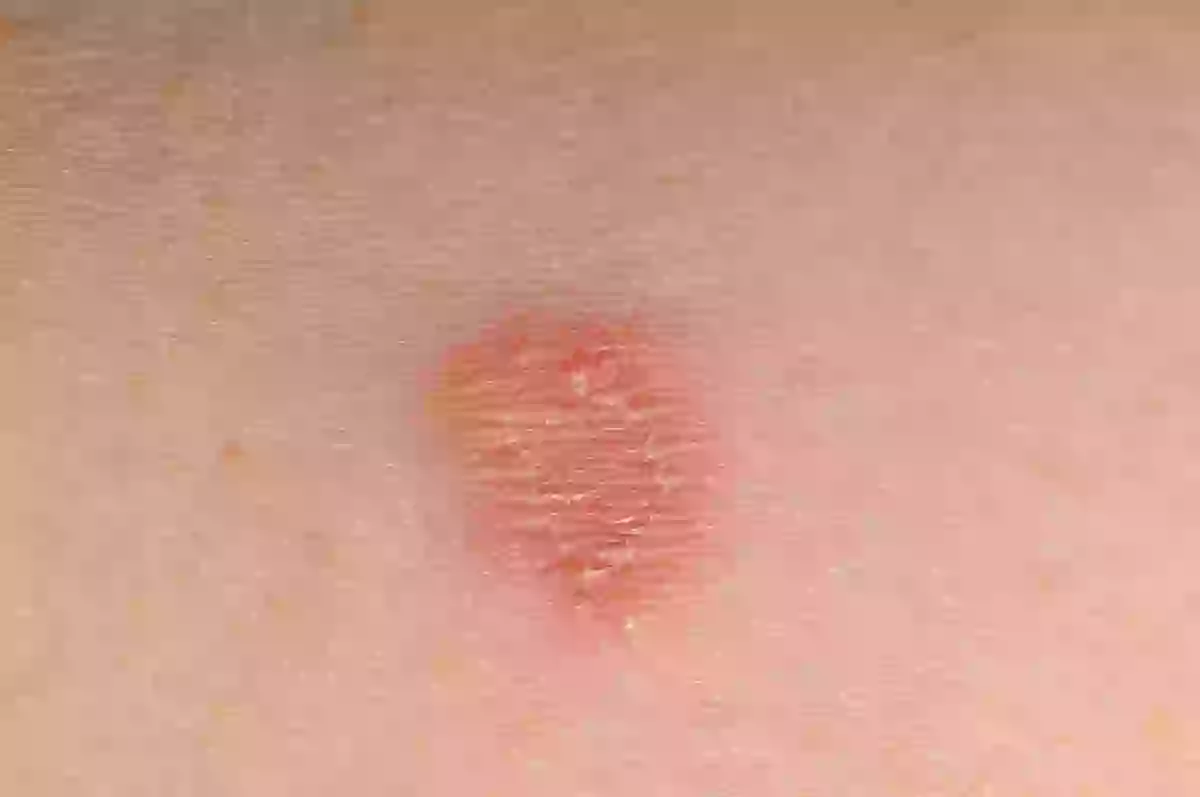 Barber S Rashes Urgent health warning issued to Brits who get skin fades at barbers
