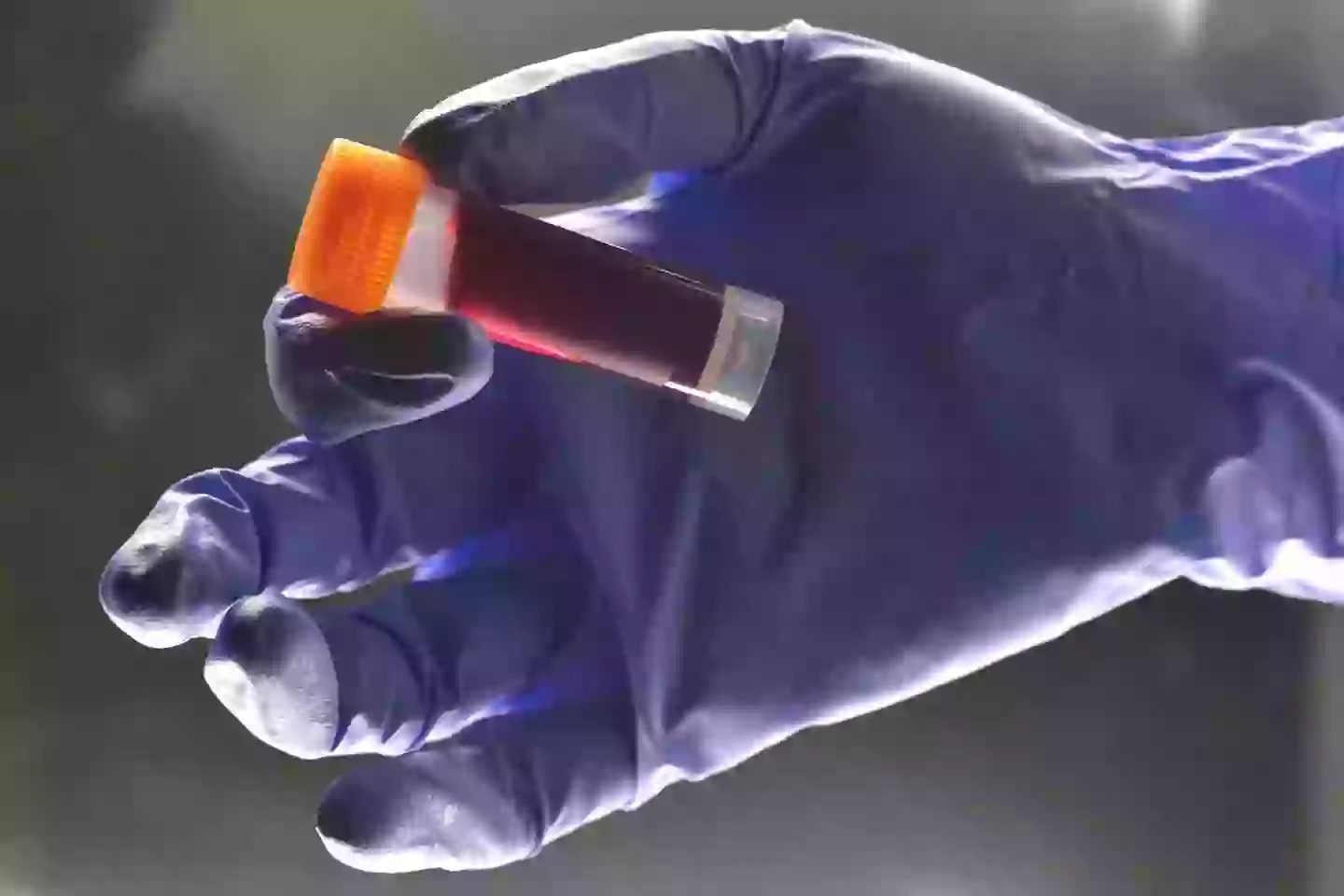 Blood Threads What your blood type actually means for your health as doctors reveal ...