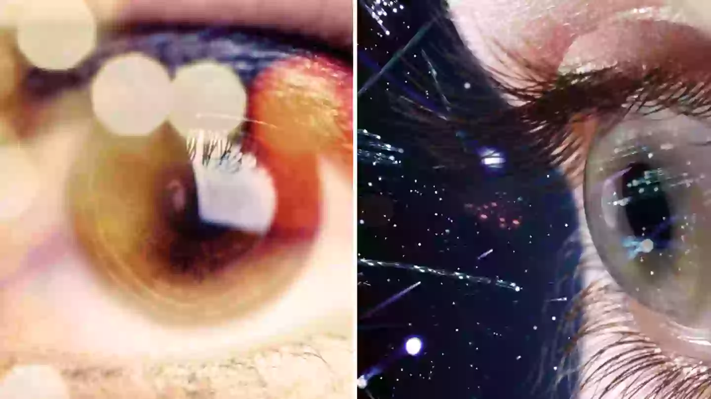 Expert Reveals Why You Sometimes Might See stars In Your Eyes expert-reveals-why-you-sometimes-might-see-stars-in-your-eyes