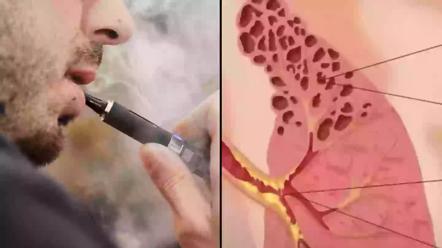 Timeline Of What Happens When You Stop Vaping After Simulation Showed timeline-of-what-happens-when-you-stop-vaping-after-simulation-showed