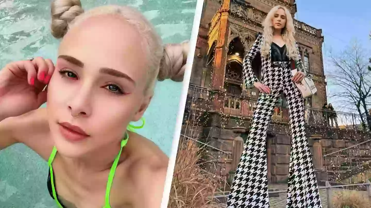 German woman who paid $165,000 to extend her legs by 5.5 inches left ...