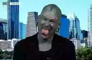 US man who 'transformed himself into a lizard' reveals horrifying ...