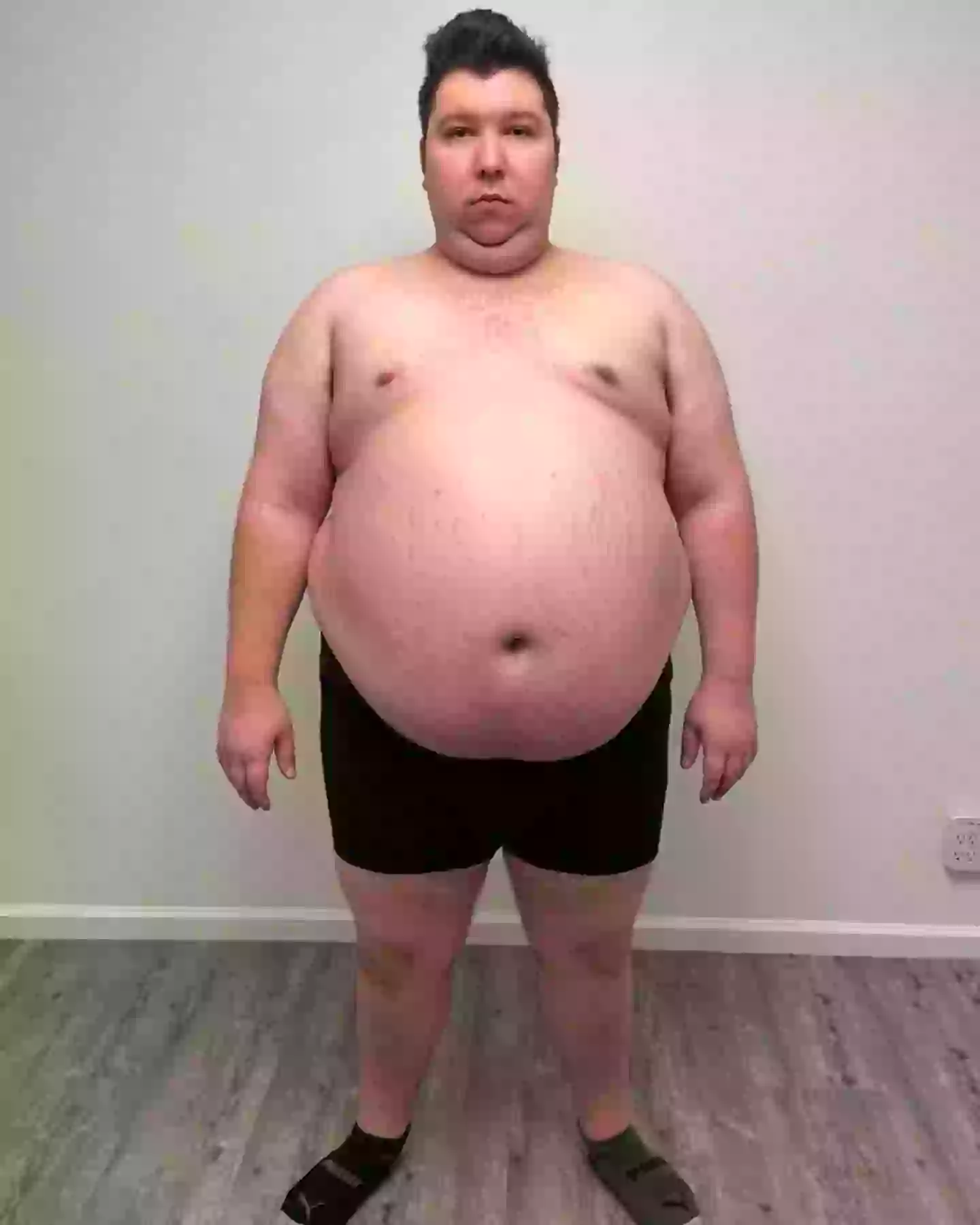 Nikocado Avocado's shocking weight loss prompts calls for Netflix ...