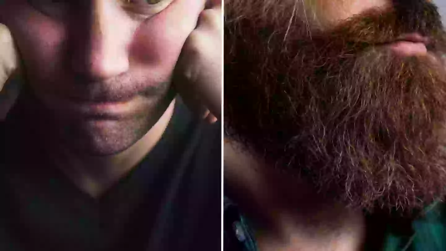 Hairy truth behind new ‘beardfishing’ dating trend that’s taking over young people