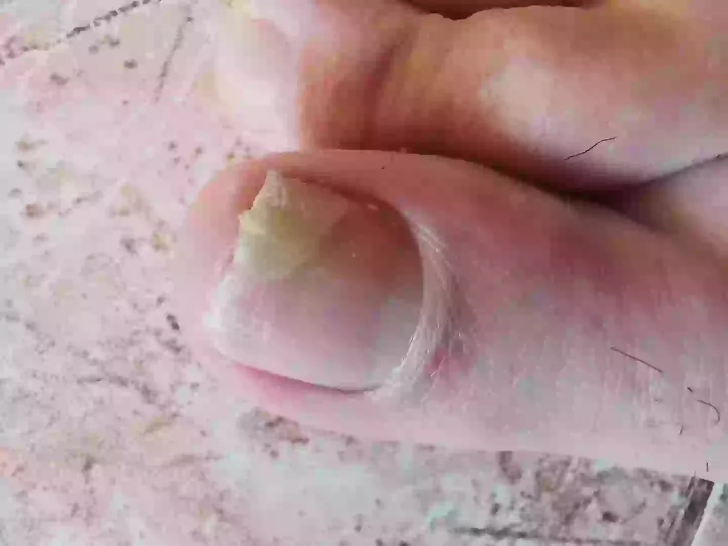 Even your nails could be an indicator (Getty stock images)