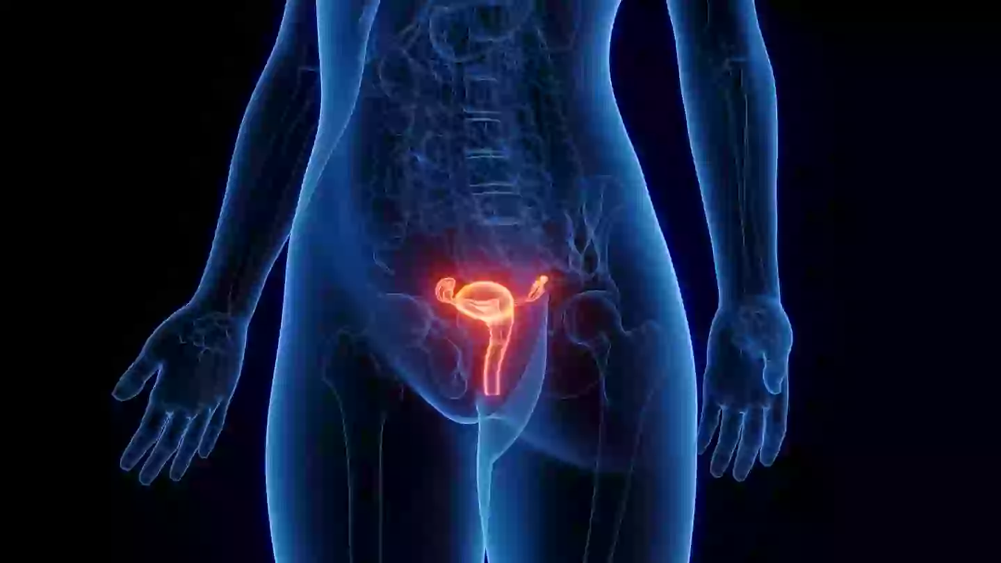 One symptom of both vaginal and vulval cancer have is vaginal bleeding (SEBASTIAN KAULITZKI/SCIENCE PHOTO LIBRARY / Getty Images)