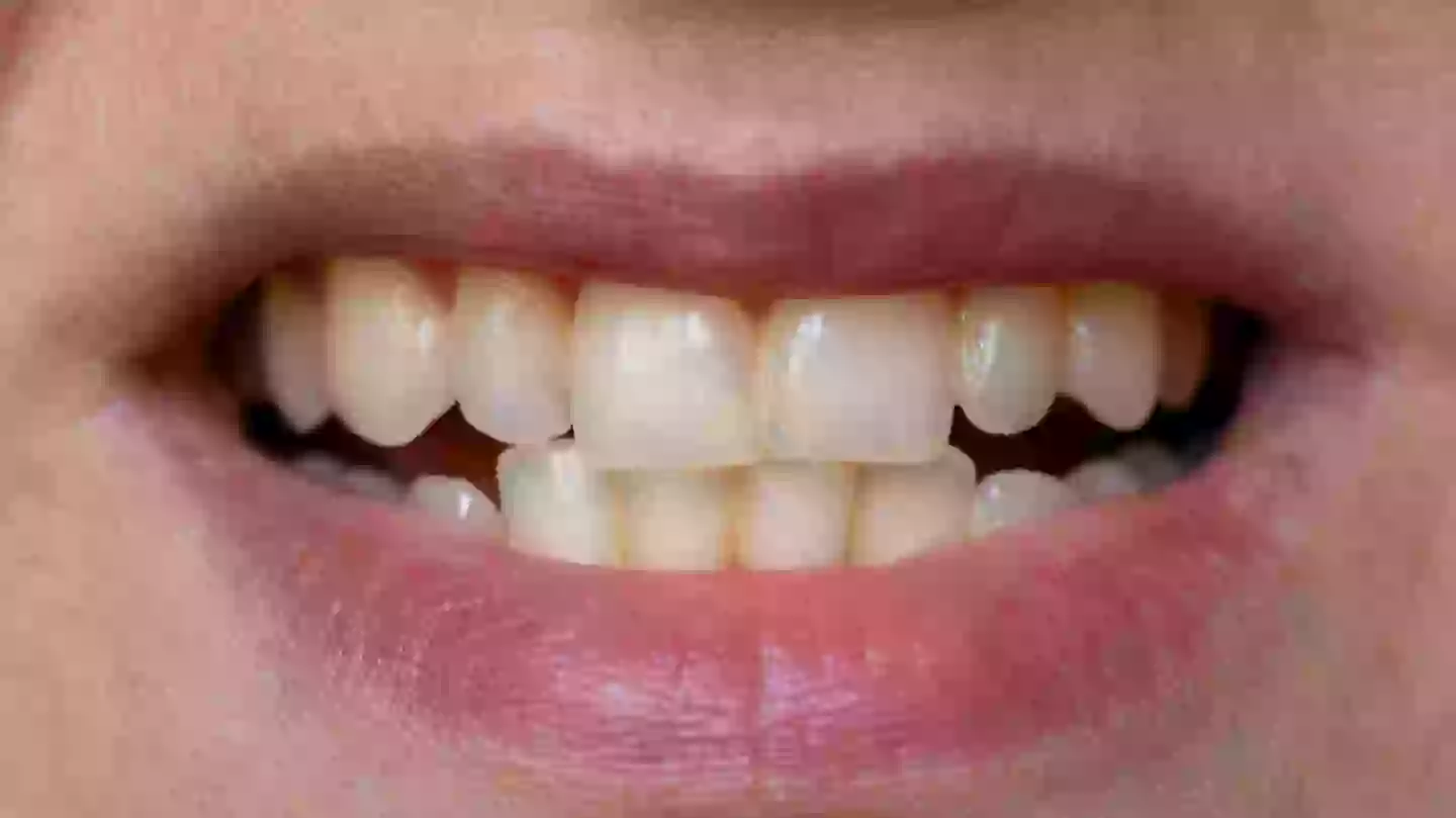Dentist reveals the seven main reasons your teeth go yellow and how you can stop it happening
