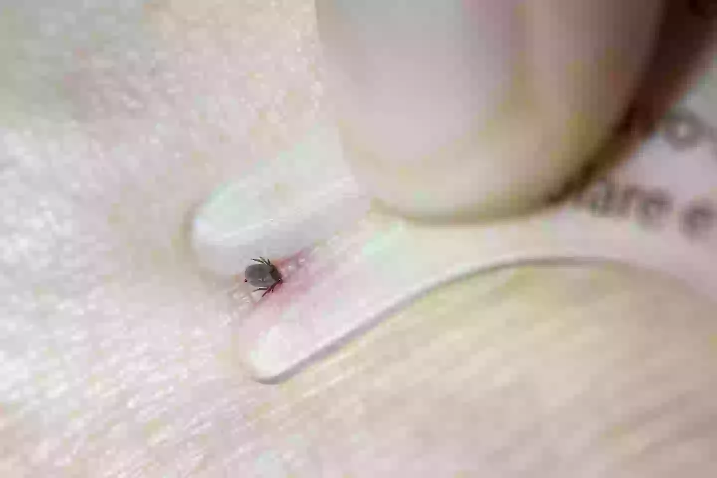 The tiny parasites feed on the blood of mammals and birds (Getty Images)