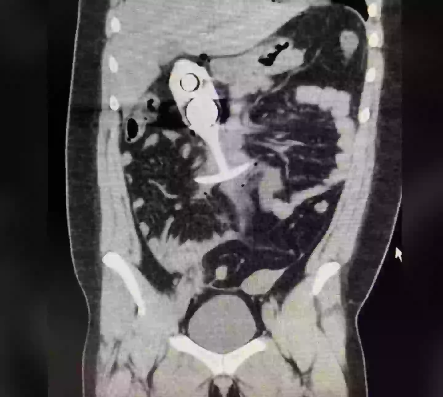 A scan showing someone with a butt plug inside them (Reddit)