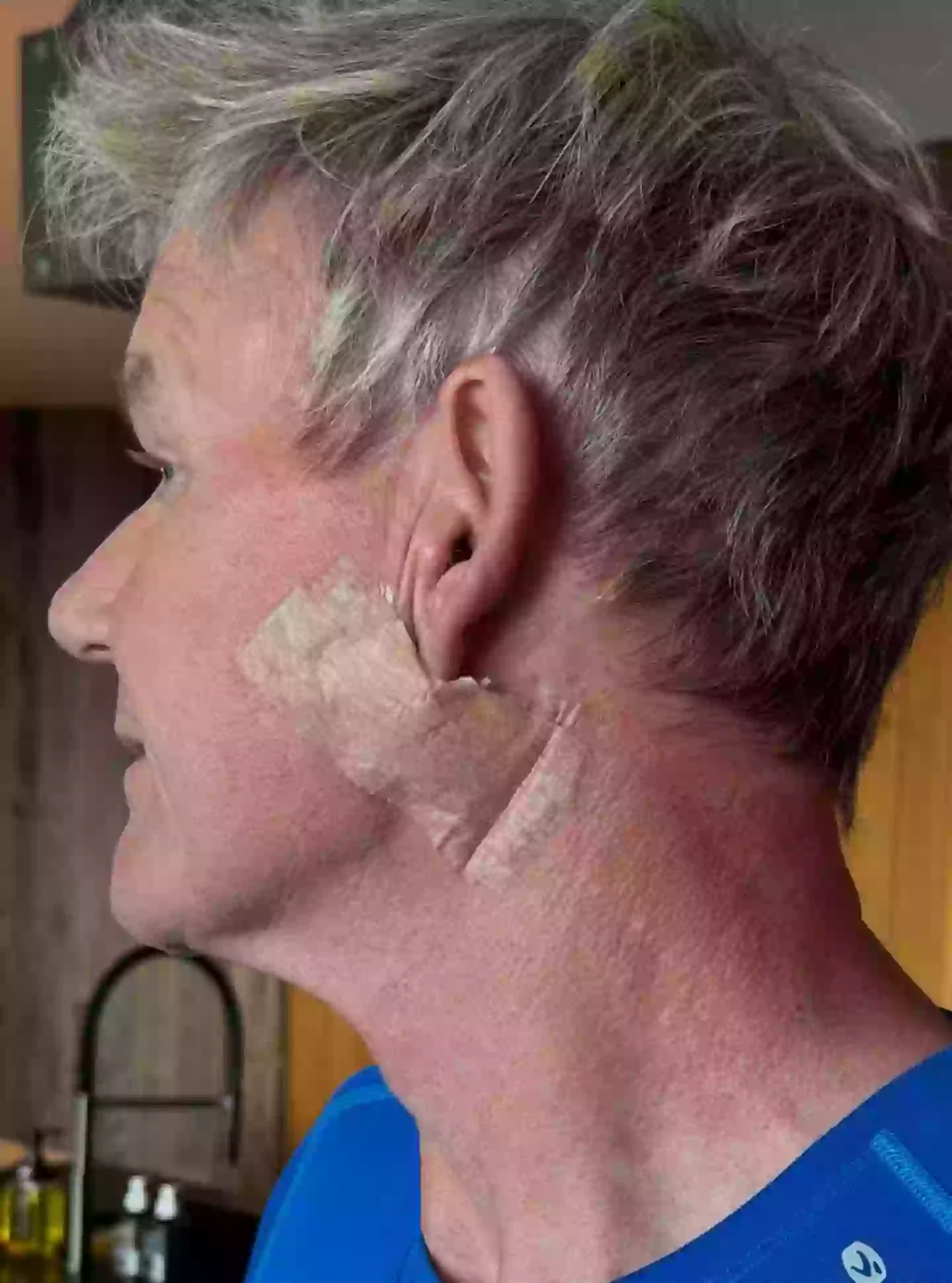 Gordan Ramsay recently had surgery (Instagram/@gordongram)