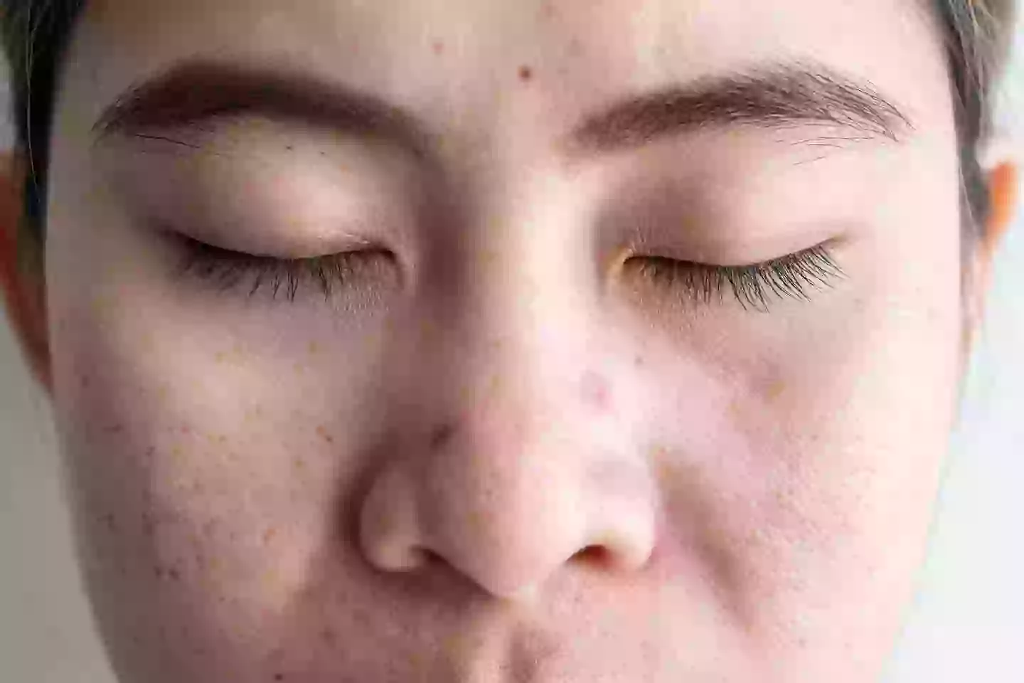 The triangle includes the nose (Getty Stock Photo)