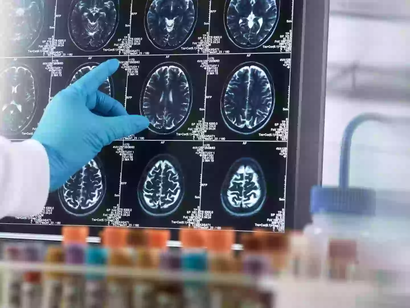 Dementia impacts around six million Americans (Tek Image/Science Photo Library/Getty Images)