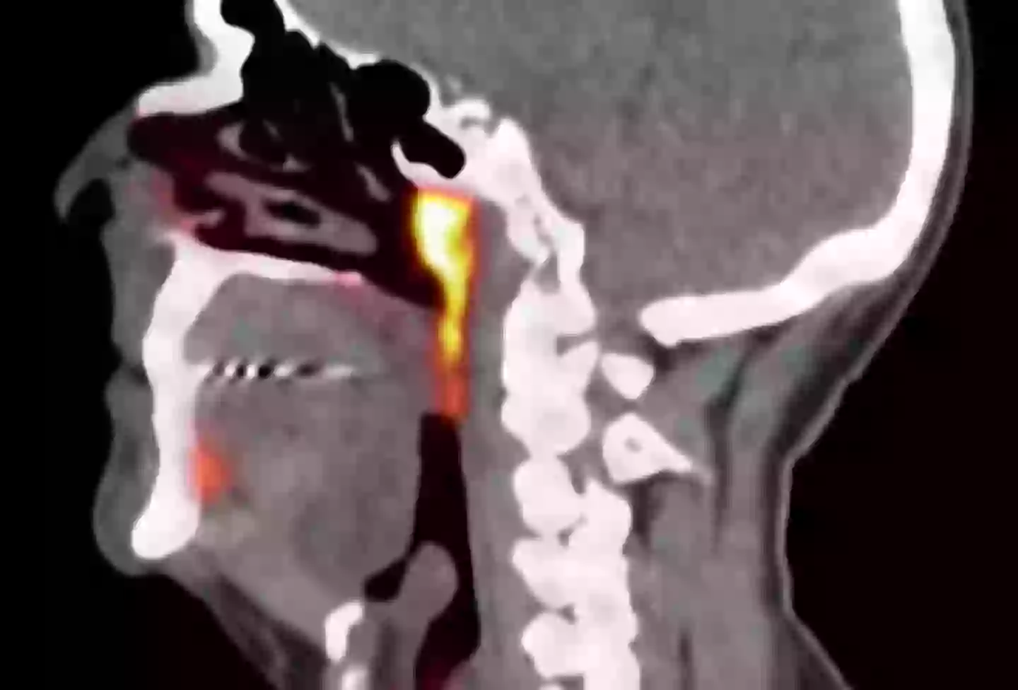 That glowing thing is the organ you never knew you had (YouTube/Antoni Van Leeuwenhoek)