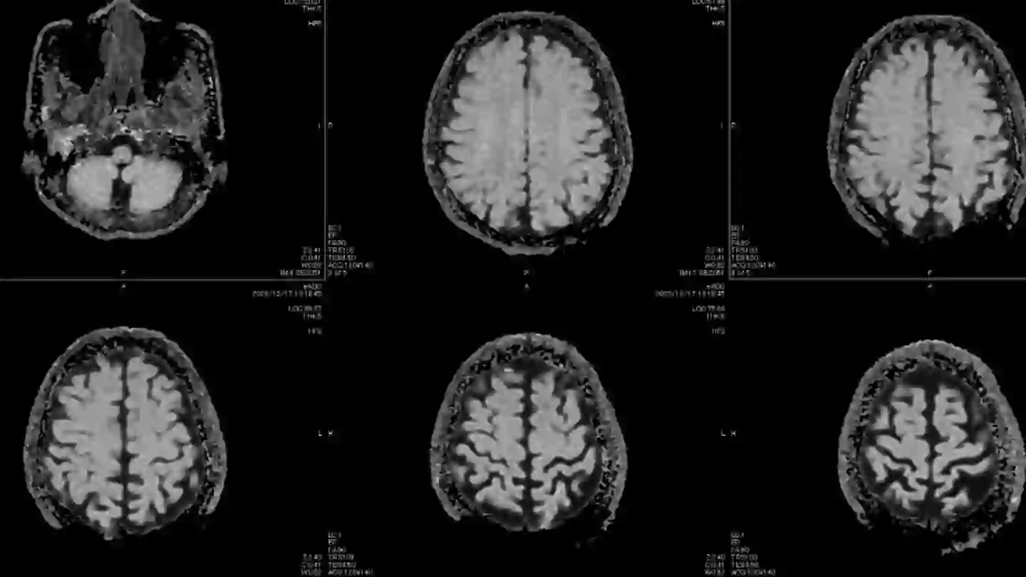 Five nurses were diagnosed with benign tumors (Getty Stock Images)