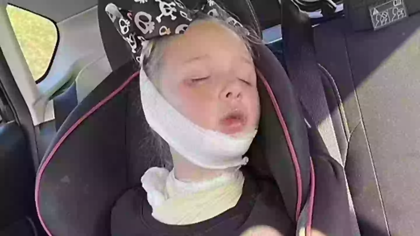 Scarlett sustained second and third-degree burns (Kennedy News and Media)