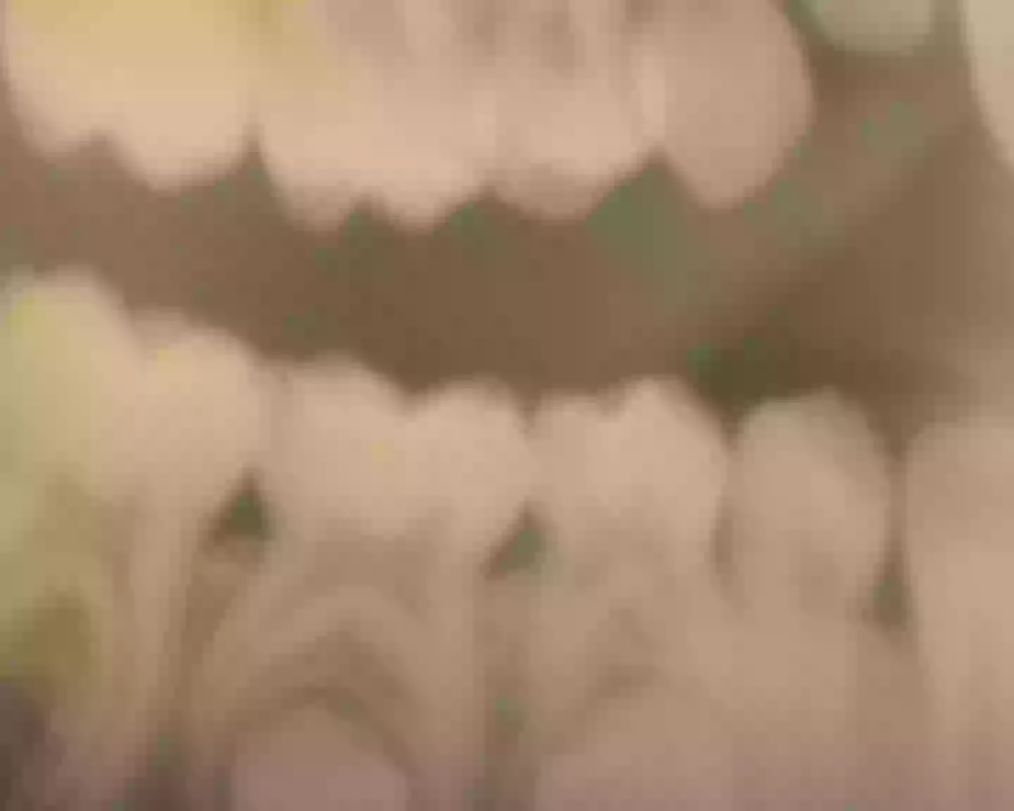 The dentist described the x-ray as 'definitive evidence'.