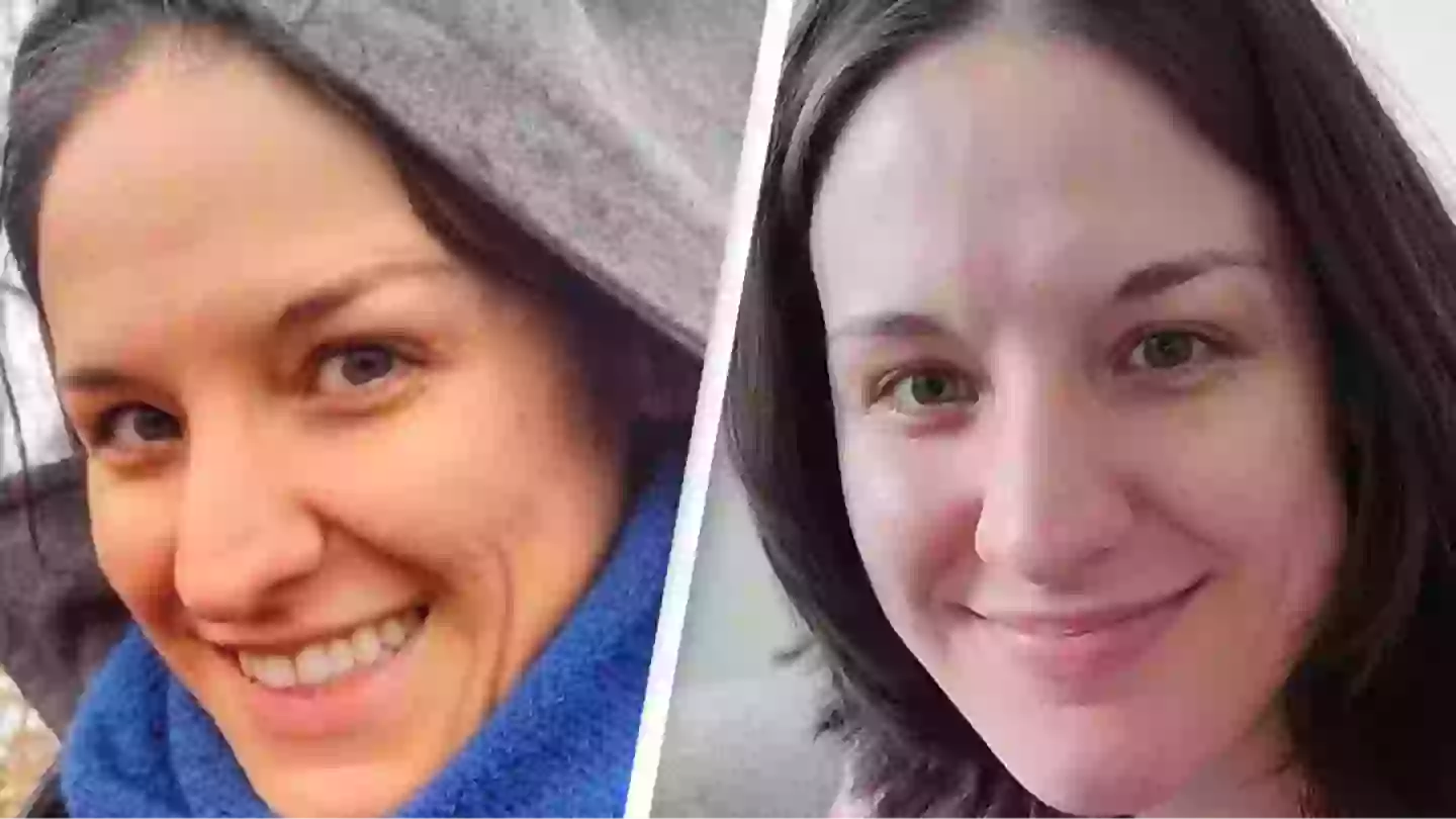 Before and after photo of woman with carotenosis reveals shocking impact of eating carrots every day