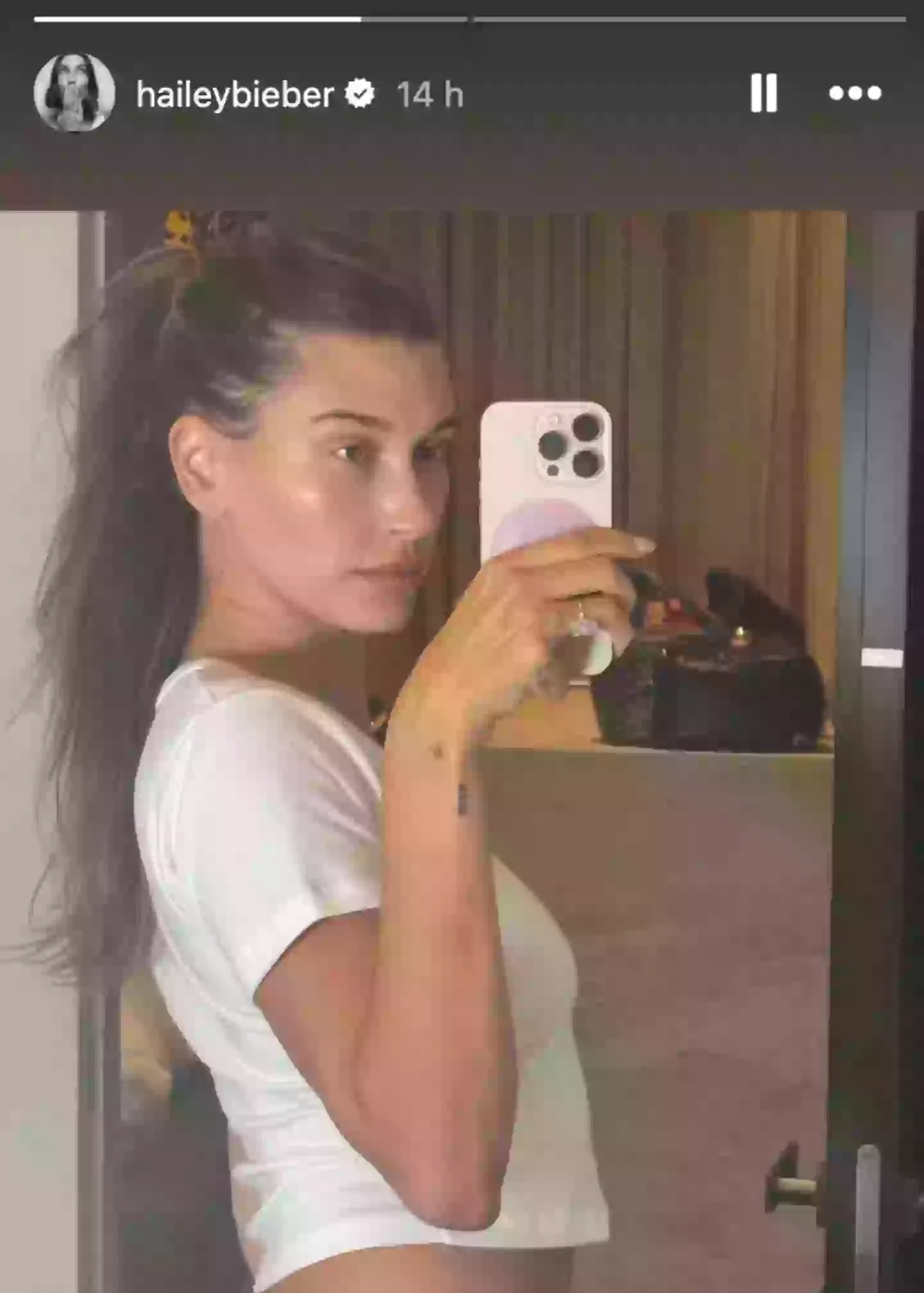 Hailey Bieber shared the selfie on her Instagram Story (Instagram/@haileybieber)