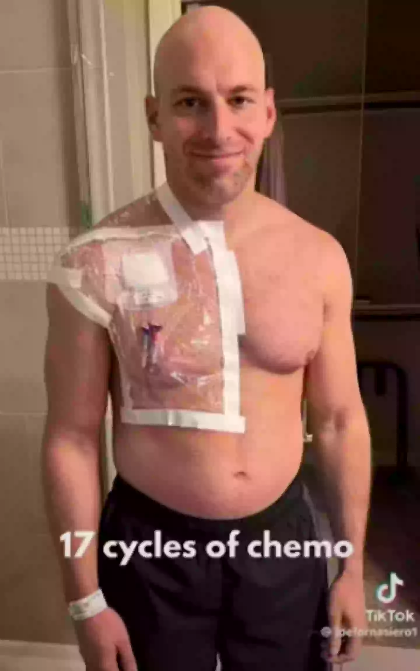 I had two 10 -hour main surgeries (the patient's story/YouTube)
