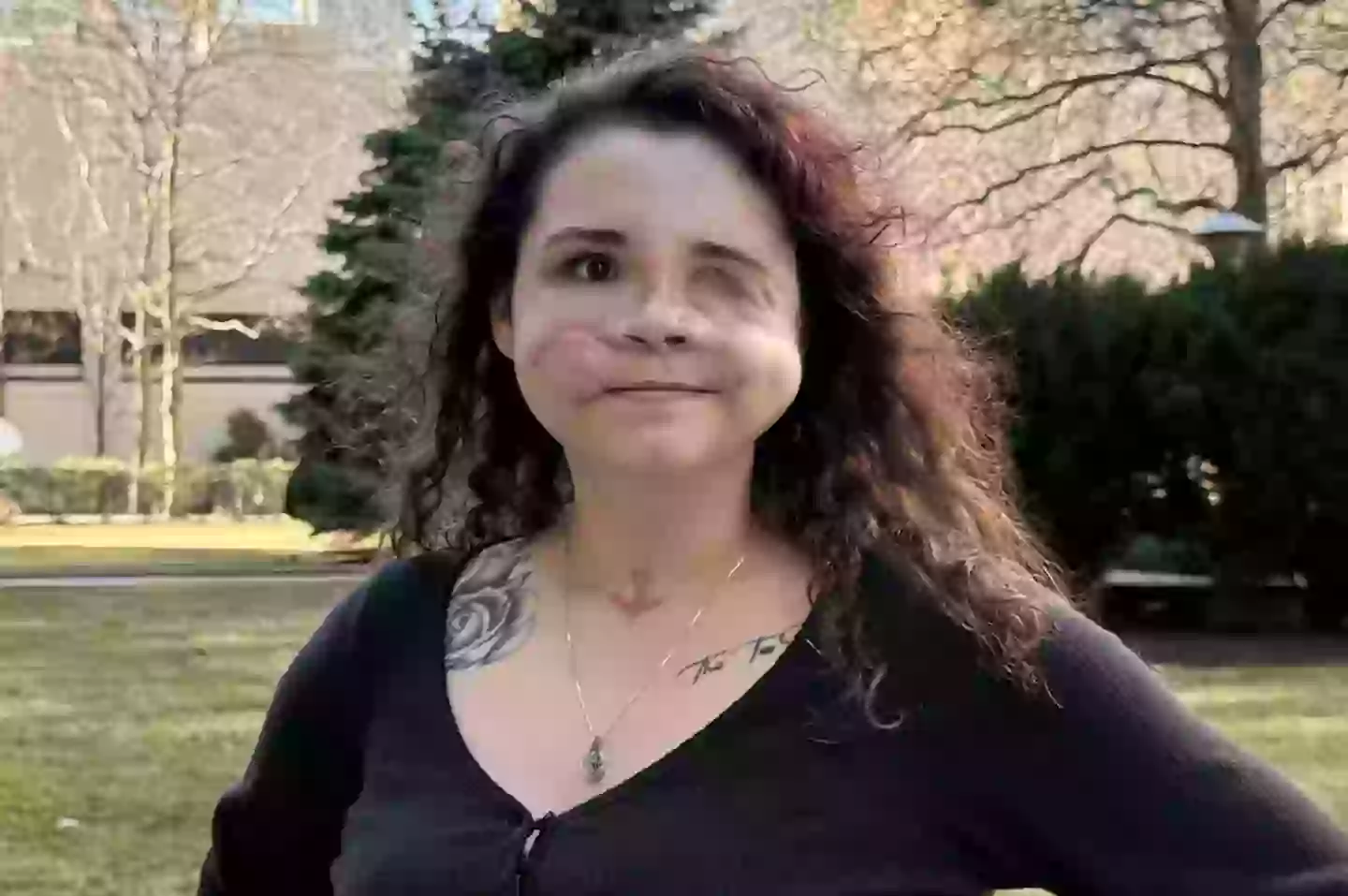 Dewey was shot in the face by her stepfather (Amedy Dewey)