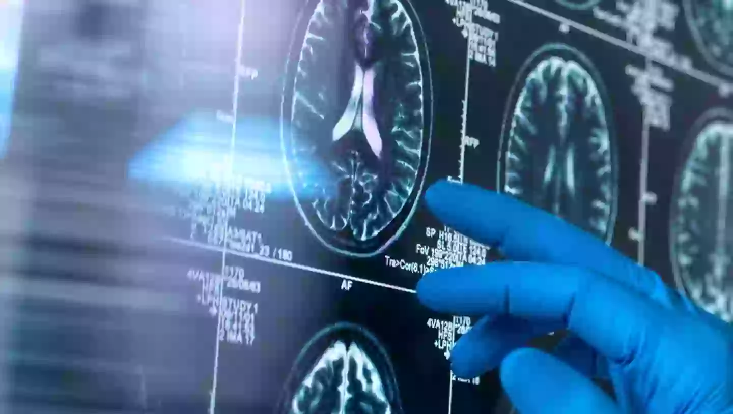 A neurological scientist has explained why she thinks women are more likely to be diagnosed with dementia than men (Getty Stock Image)