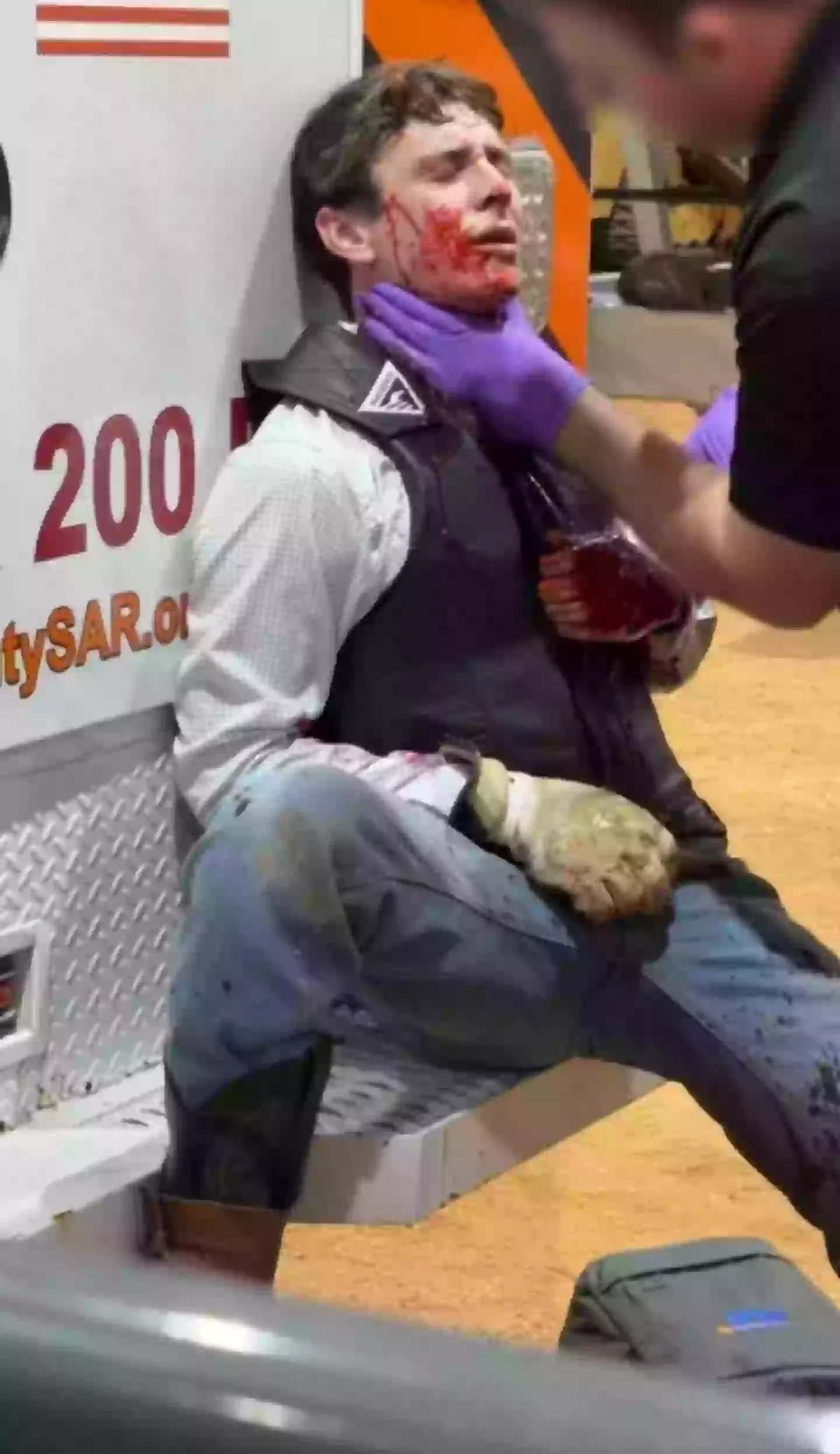 At first, he thought he had only been scratched until he saw the blood (Kennedy News and Media)