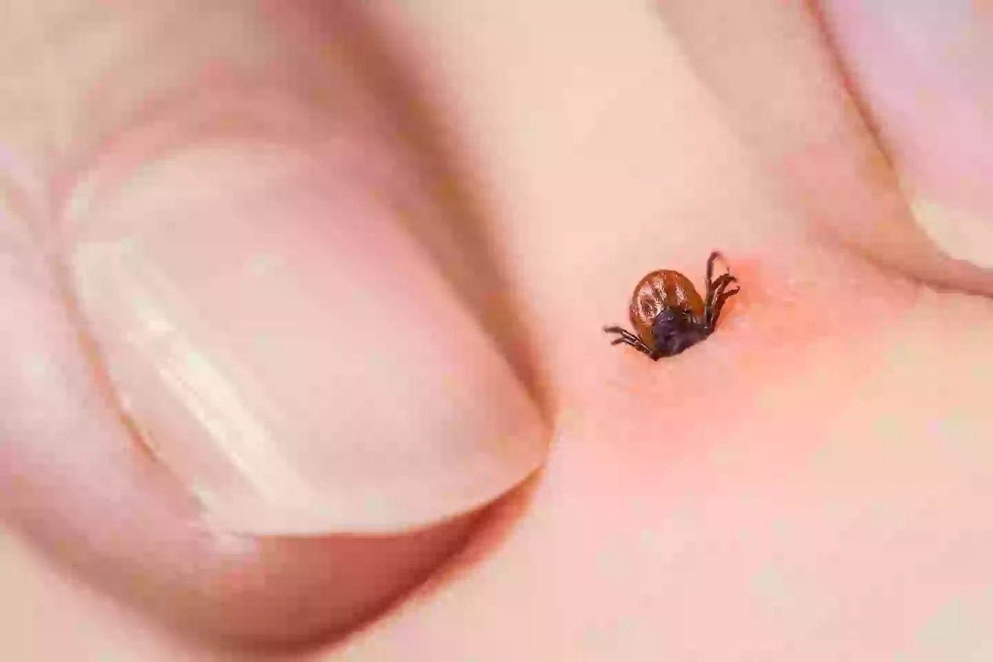Ticks can infect people with Lyme disease (Getty Images)