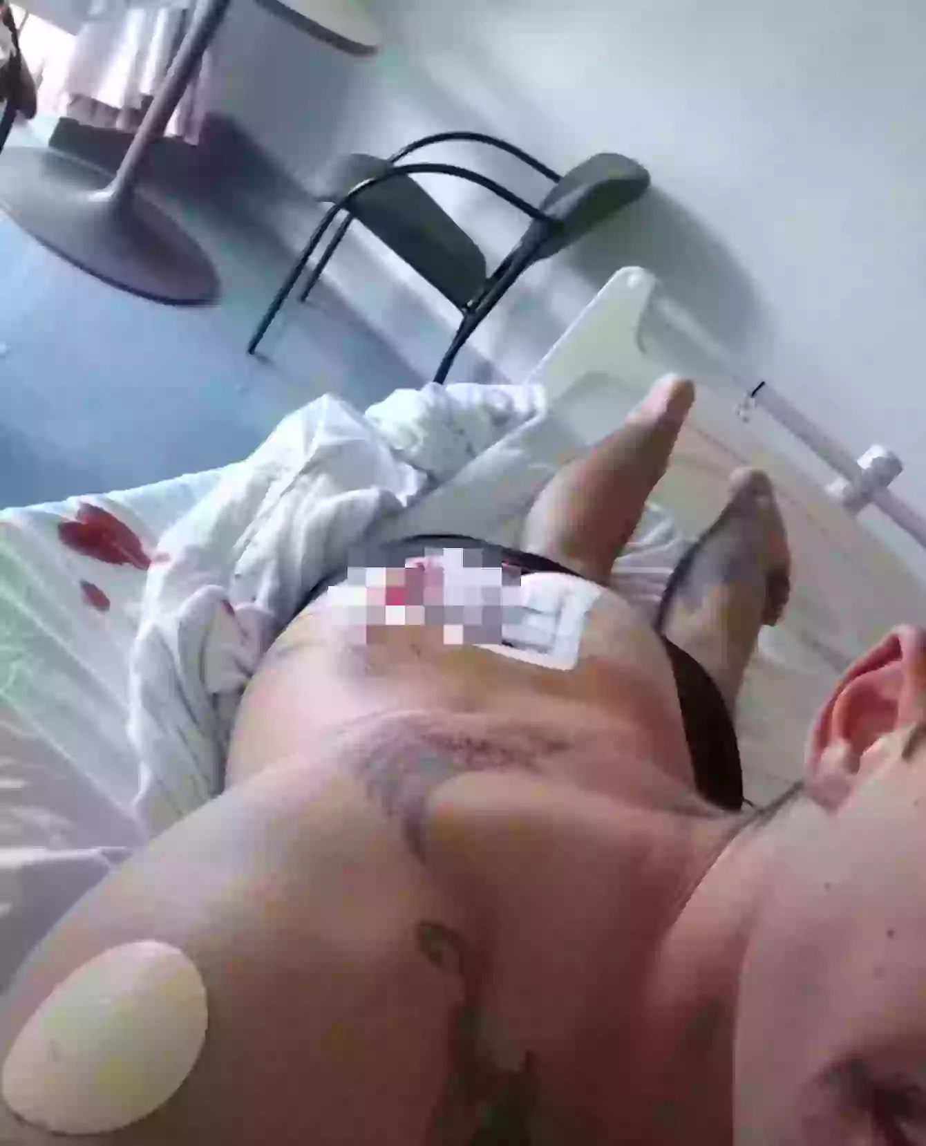 As of 2022, Dylan had been operated on nine times (ABC Science/YouTube)