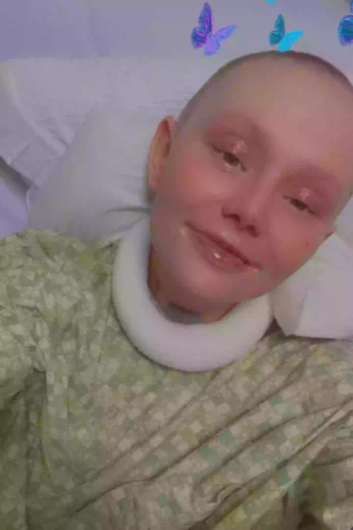 A mom experienced '95 percent' of her skin falling off after suffering a rare condition (Kennedy News)