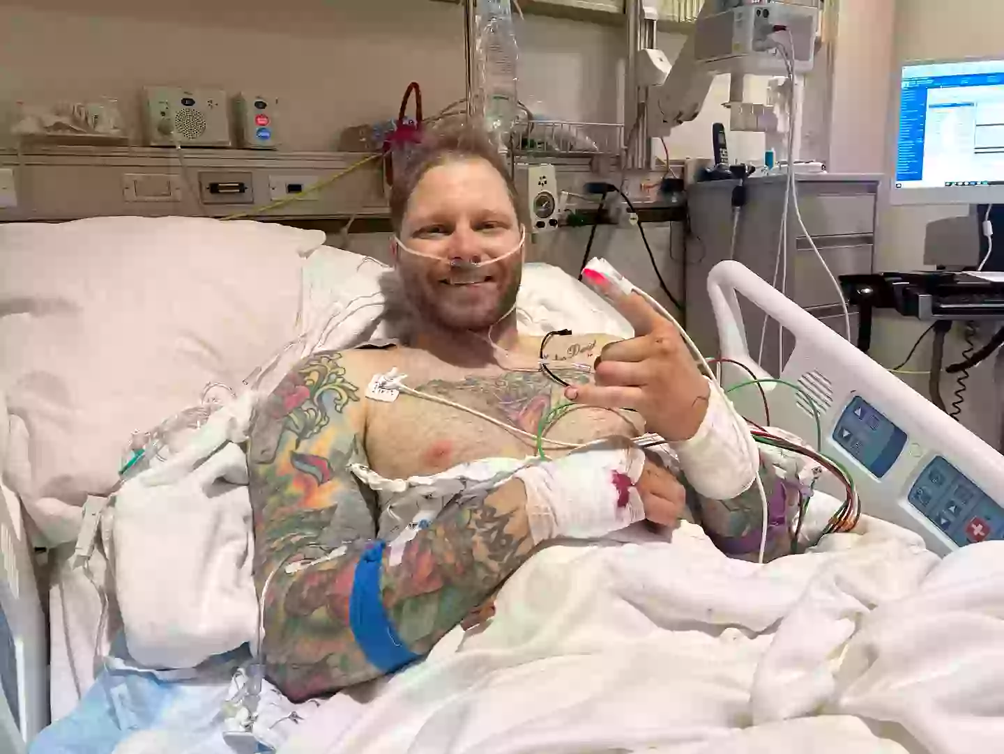 Incredibly, Burke was only hospitalized for one day before being discharged (Shayne Burke)