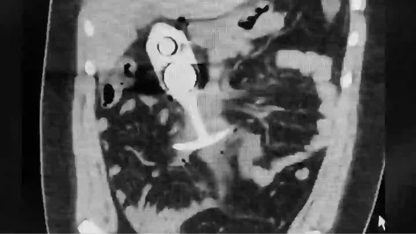 Woman left 'screaming' in pain after leaving sex toy in during MRI as warnings are issued