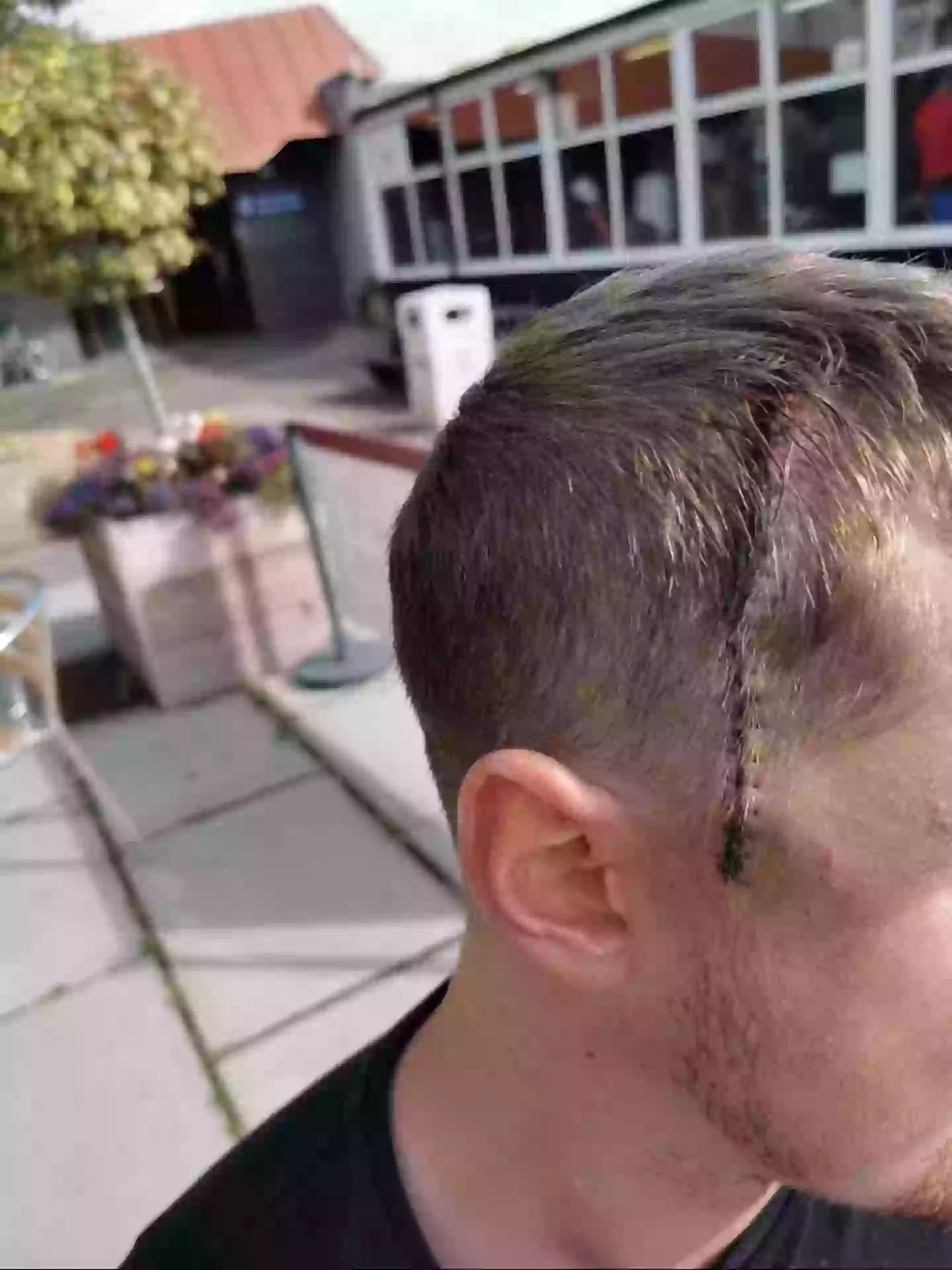 Hinch has had multiple rounds of treatment as his cancer came back(SWNS)